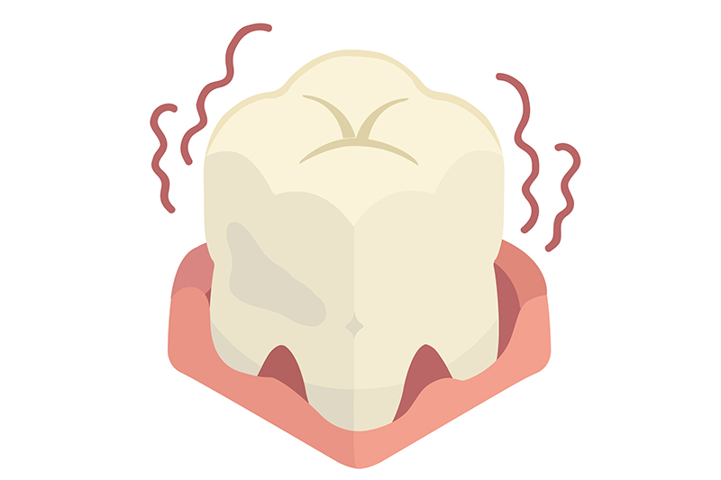 歯を支える骨が痩せる