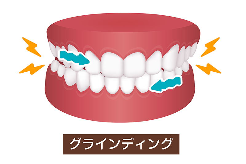 上下の歯をこすり合わせるタイプ
